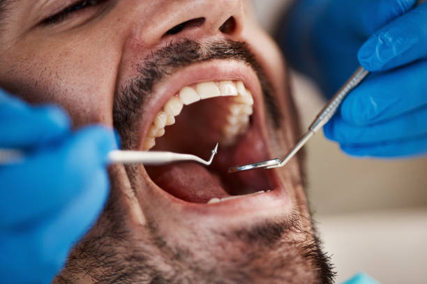 Best Emergency TMJ Treatment in Glenmont, MD
