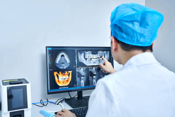 Best Emergency Root Canal Treatment in Glenmont, MD